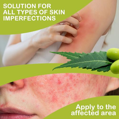 Neemöl von – Ultra Konzentriertes Virgin Öl für effektive Schädlingsbekämpfung im Garten – 1000 ml Lösung gegen Parasit